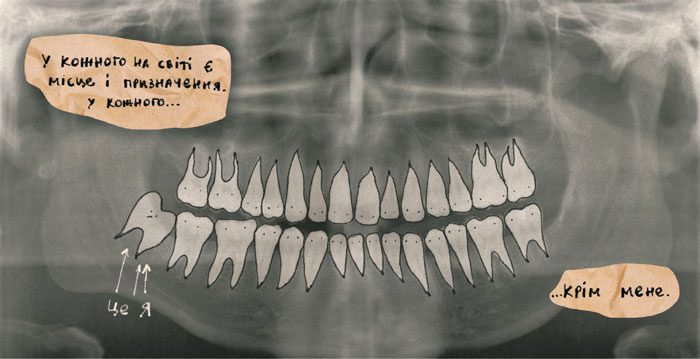 Надьожна: Зуб
